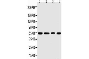 Anti-TRAF4 antibody, Western blotting Lane 1: Rat Thymus Tissue Lysate Lane 2: HELA Cell Lysate Lane 3: JURKAT Cell Lysate Lane 4: HEPA Cell Lysate