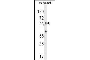 Western blot analysis in mouse heart tissue lysates (35ug/lane). (SP8 Antikörper  (C-Term))