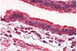 Lung, respiratory epithelium, Human: Formalin-Fixed, Paraffin-Embedded (FFPE) (ADGRV1 / GPR98 Antikörper  (Internal Region))