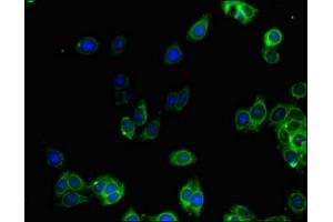 Immunofluorescent analysis of HepG2 cells using ABIN7143463 at dilution of 1:100 and Alexa Fluor 488-congugated AffiniPure Goat Anti-Rabbit IgG(H+L) (GGA1 Antikörper  (AA 1-89))