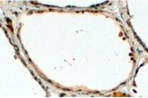 Immunohistochemistry (IHC) image for anti-Dual Oxidase 1 (DUOX1) (Internal Region) antibody (ABIN2465619)