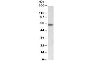 Western blot testing of MOLT4 lysate with SOX11 antibody at 0. (SOX11 Antikörper)