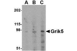 Western blot analysis of Grik5 in human brain tissue lysate with AP30386PU-N Grik5 antibody at (A) 0. (GRIK5 Antikörper  (C-Term))