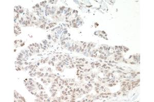 Immunohistochemistry (IHC) image for anti-Interleukin enhancer-binding factor 3 (ILF3) (AA 456-506) antibody (ABIN7453567) (Interleukin enhancer-binding factor 3 (ILF3) (AA 456-506) Antikörper)