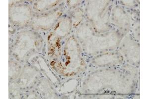 Image no. 2 for anti-Endothelial Cell-Specific Molecule 1 (ESM1) (AA 85-185) antibody (ABIN466176) (ESM1 Antikörper  (AA 85-185))