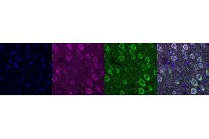 Immunohistochemistry (IHC) image for anti-Ubiquitin Carboxyl-terminal Esterase L1 (Ubiquitin Thiolesterase) (UCHL1) antibody (ABIN7456167) (UCHL1 Antikörper)