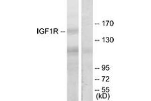 Western blot analysis of extracts from 293 cells, treated with Insulin, using IGF1R (Ab-1165/1166) Antibody. (IGF1R Antikörper  (AA 1131-1180))