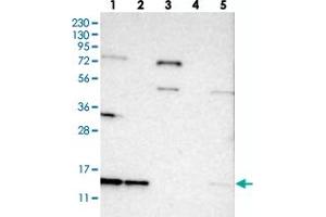 Western blot analysis of Lane 1: RT-4, Lane 2: U-251 MG, Lane 3: Human Plasma, Lane 4: Liver, Lane 5: Tonsil with SNRPD3 polyclonal antibody  at 1:250-1:500 dilution. (SNRPD3 Antikörper)