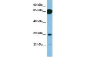 Image no. 1 for anti-Small Nuclear Ribonucleoprotein Polypeptide N (SNRPN) (AA 46-95) antibody (ABIN6746188) (SNRPN Antikörper  (AA 46-95))