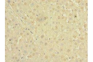 Immunohistochemistry of paraffin-embedded human liver tissue using ABIN7154980 at dilution of 1:100 (Hemoglobin, epsilon 1 (HBe1) (AA 2-147) Antikörper)