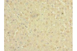 Immunohistochemistry of paraffin-embedded human liver tissue using ABIN7154980 at dilution of 1:100