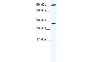 WB Suggested Anti-PAntibody Titration:  0. (PARP16 Antikörper  (N-Term))