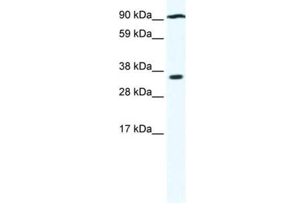 PARP16 Antikörper  (N-Term)