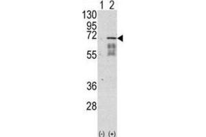 Western Blotting (WB) image for anti-Activin Receptor Type I (ACRV1) antibody (ABIN3002992) (ACVR1 Antikörper)