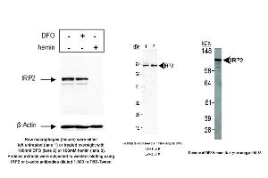 Image no. 5 for anti-Iron-Responsive Element Binding Protein 2 (IREB2) antibody (ABIN363497)