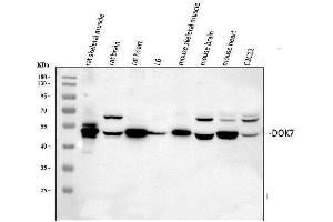 Western blot analysis of DOK7 using anti-DOK7 antibody (ABIN6719428). (DOK7 Antikörper)