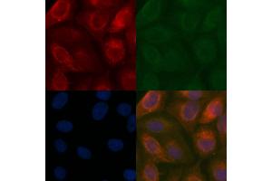 EIF5 Mouse Monoclonal Antibody staining Hela cells by IF/ICC.