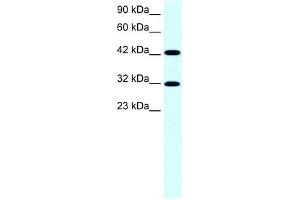 WB Suggested Anti-GTF2H2 Antibody Titration:  0. (GTF2H2 Antikörper  (Middle Region))