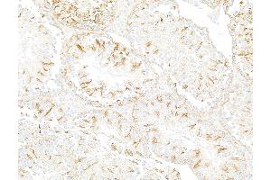 Immunohistochemistry (IHC) image for anti-Tubulin, beta (TUBB) (AA 1-50) antibody (ABIN7453995) (Rekombinanter TUBB Antikörper  (AA 1-50))