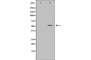 TXNRD2 Antikörper  (C-Term)