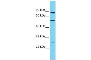 Western Blotting (WB) image for anti-Transmembrane Protease, Serine 9 (TMPRSS9) (N-Term) antibody (ABIN2790876)