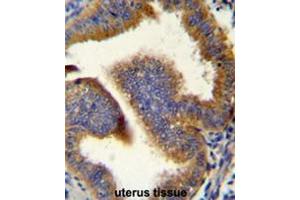 CCNB1 Antibody (C-term) immunohistochemistry analysis in formalin fixed and paraffin embedded human uterus tissue followed by peroxidase conjugation of the secondary antibody and DAB staining. (Cyclin B1 Antikörper  (C-Term))