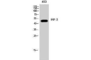 Western Blotting (WB) image for anti-Interferon Regulatory Factor 3 (IRF3) (Ser605) antibody (ABIN3185227) (IRF3 Antikörper  (Ser605))