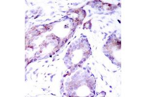 Immunohistochemistry (IHC) image for anti-Myc Proto-Oncogene protein (MYC) (pSer373) antibody (ABIN3019599) (c-MYC Antikörper  (pSer373))