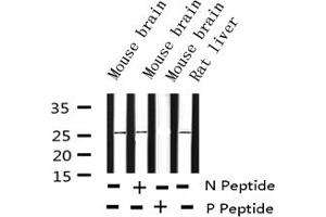 Western blot analysis of Phospho-eIF4E (Ser209) expression in various lysates (EIF4E Antikörper  (pSer209))