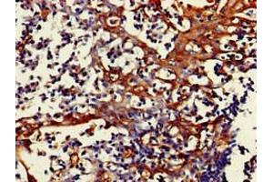 Immunohistochemistry of paraffin-embedded human tonsil tissue using ABIN7160758 at dilution of 1:100 (FPR3 Antikörper  (AA 307-353))