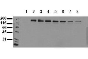 Western Blotting (WB) image for anti-Receptor tyrosine-protein kinase erbB-2 (ErbB2/Her2) (pTyr1248) antibody (ABIN126792) (ErbB2/Her2 Antikörper  (pTyr1248))