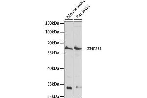 Western blot analysis of extracts of various cell lines, using ZNF331 antibody (ABIN7271477) at 1:1000 dilution. (ZNF331 Antikörper  (AA 50-130))