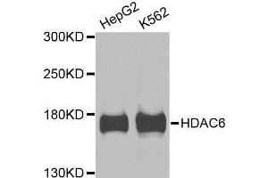 Western blot analysis of extracts of various cell lines, using HDAC6 antibody. (HDAC6 Antikörper  (AA 1-200))