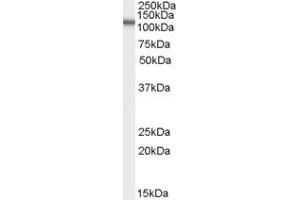 Western Blotting (WB) image for anti-Family with Sequence Similarity 188, Member A (FAM188A) (N-Term) antibody (ABIN2789239)