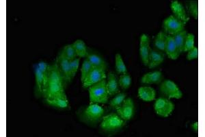 Immunofluorescent analysis of HepG2 cells using ABIN7173317 at dilution of 1:100 and Alexa Fluor 488-congugated AffiniPure Goat Anti-Rabbit IgG(H+L) (Transportin 3 Antikörper  (AA 382-458))