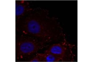 Image no. 1 for anti-Paxillin (PXN) (pTyr88) antibody (ABIN401592) (Paxillin Antikörper  (pTyr88))