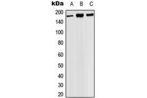 Western blot analysis of PHLPP expression in HEK293T (A), SP2/0 (B), PC12 (C) whole cell lysates. (PHLPP1 Antikörper  (C-Term))
