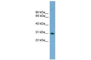 HLA-DQA2 antibody used at 1 ug/ml to detect target protein. (HLA-DQA2 Antikörper  (N-Term))