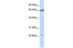P2RX2 antibody used at 1 ug/ml to detect target protein.