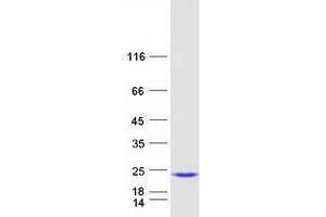 Western Blotting (WB) image for Interleukin 1 Family, Member 10 (Theta) (IL1F10) (Transcript Variant 1) protein (Myc-DYKDDDDK Tag) (ABIN2723370)