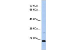 Western Blotting (WB) image for anti-Protoporphyrinogen Oxidase (PPOX) (C-Term) antibody (ABIN2786510) (PPOX Antikörper  (C-Term))