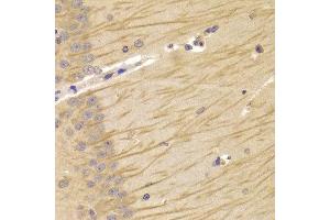 Immunohistochemistry of paraffin-embedded Mouse brain using TCN2 antibody at dilution of 1:100 (x400 lens). (TCN2 Antikörper)