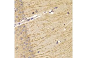Immunohistochemistry of paraffin-embedded Mouse brain using TCN2 antibody at dilution of 1:100 (x400 lens).
