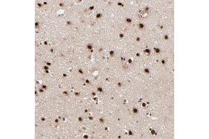 Immunohistochemical staining of human cerebral cortex with RBM22 polyclonal antibody  shows strong nuclear positivity in neuronal cells at 1:20-1:50 dilution. (RBM22 Antikörper)