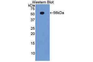 Western Blotting (WB) image for anti-Integrin beta 2 (ITGB2) (AA 124-363) antibody (ABIN1859504) (Integrin beta 2 Antikörper  (AA 124-363))