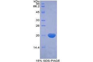 SDS-PAGE analysis of Human RXFP1 Protein. (Relaxin/insulin-Like Family Peptide Receptor 1 (RXFP1) Peptid)