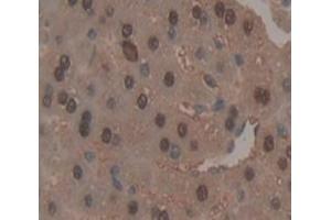 Used in DAB staining on fromalin fixed paraffin- embedded Kidney tissue (PLCB3 Antikörper  (AA 318-468))