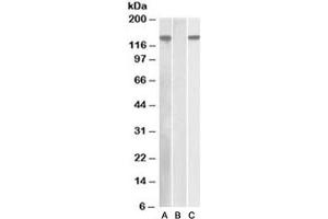 Western blot of HEK293 lysate overexpressing human NLRP2 with DYKDDDDK tag probed with NALP2 antibody [1ug/ml] in Lane A and probed with anti-DYKDDDDK tag [1/1000] in lane C. (NLRP2 Antikörper)