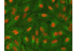 IF analysis of SAP130 using anti-SAP130 antibody (ABIN7601247) and anti-Tubulin Alpha antibody (ABIN7600339). (SAP130 Antikörper  (AA 309-913))