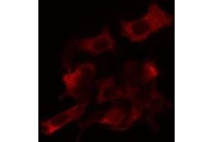 ABIN6266813 staining Hela cells by IF/ICC. (AGPAT9 Antikörper  (Internal Region))